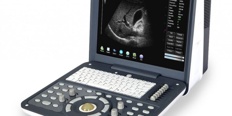 Выбор портативной УЗИ-системы