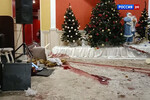 «Осколок чудом не задел легкое». Рогозину сделают операцию в московском госпитале 