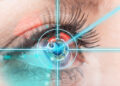 Возрастные ограничения для лазерной коррекция зрения
