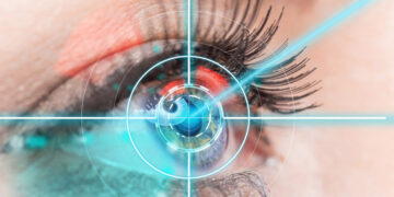 Возрастные ограничения для лазерной коррекция зрения