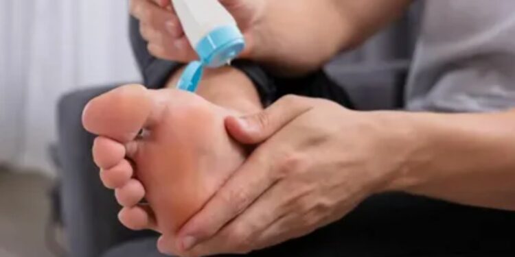 Лечение мозолей: когда домашнее лечение не помогает