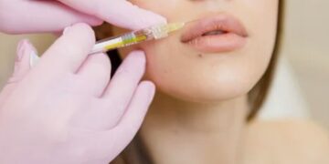 Увеличение губ: современные техники и безопасные решения