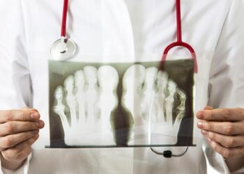 Профессор Виктор Процко: Стопа предупредит о возможной болезни Паркинсона