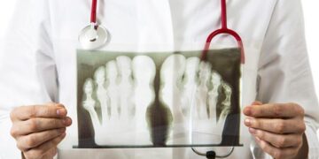 Профессор Виктор Процко: Стопа предупредит о возможной болезни Паркинсона