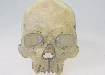 Ученые обнаружили в 4000-летних скелетах из Чили редкую форму проказы