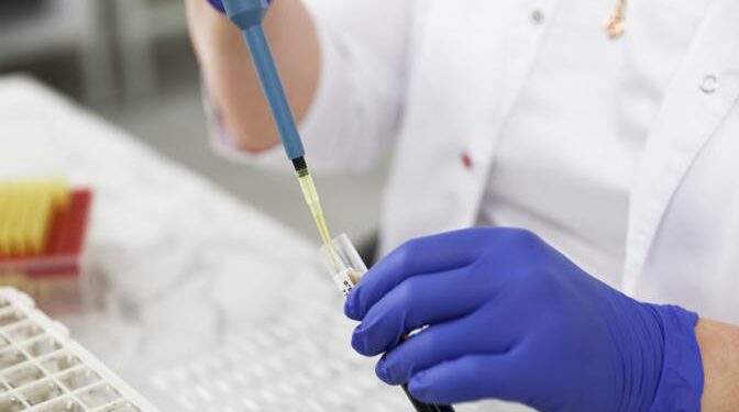 Удар по почкам: Простой анализ, который поможет не пропустить смертельно опасное заболевание