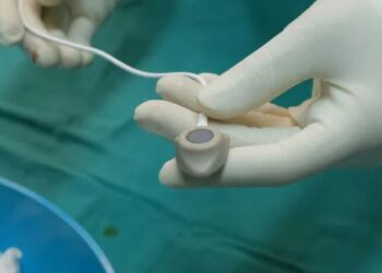 Порт-система — комфорт в лечении: почему это работает и кому подходит