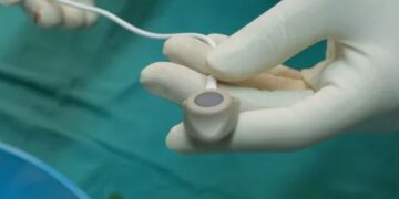 Порт-система — комфорт в лечении: почему это работает и кому подходит