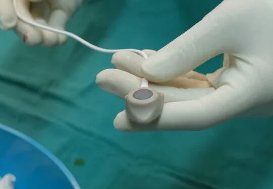 Порт-система — комфорт в лечении: почему это работает и кому подходит