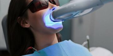 Отбеливание зубов: что реально работает и как не навредить себе