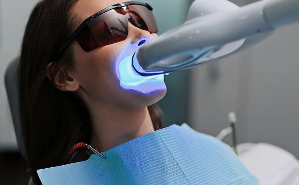 Отбеливание зубов: что реально работает и как не навредить себе
