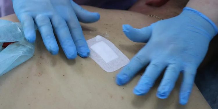 Кодировка «Торпедо»: маленькая ампула, большое решение