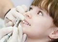 От молочных до постоянных: профессиональная чистка зубов в детском возрасте