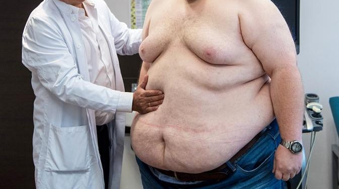 Слишком жирно — терять триллионы рублей из-за не в меру упитанных сограждан