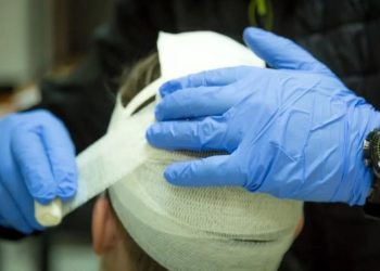 Это надо лечить. Даже легкая травма головы повышает риск Альцгеймера