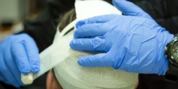 Это надо лечить. Даже легкая травма головы повышает риск Альцгеймера