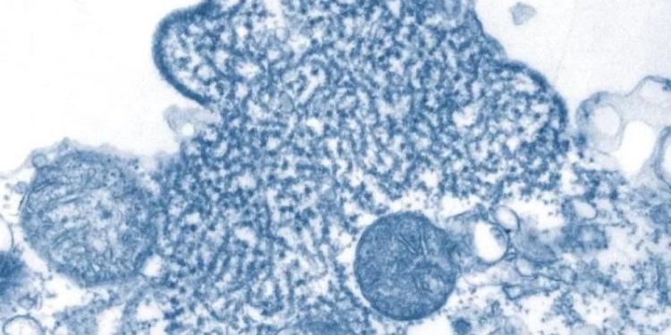 Учёные КНР заявили, что нашли препарат, способный побороть вирус Нипах