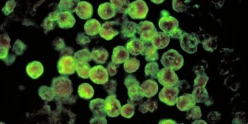 Амёба, пожирающая мозг. Стало известно о новой угрозе потепления климата