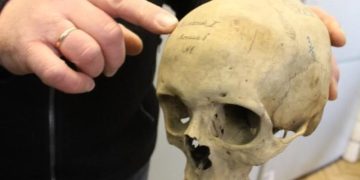 Портал в голове. Зачем древние врачи по всему миру вскрывали черепа?