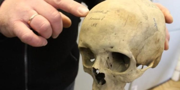 Портал в голове. Зачем древние врачи по всему миру вскрывали черепа?