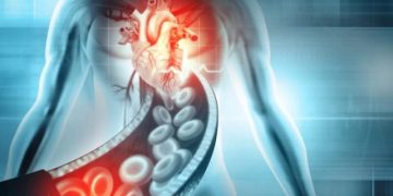 Science: иммунотерапию рака могут использовать против сосудистых бляшек