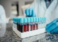 Ученые научились предсказывать смерть человека по одному из анализов крови