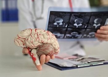 Учёные нашли естественный способ замедлить развитие болезни Альцгеймера