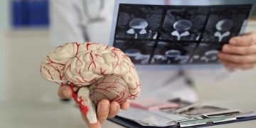 Учёные нашли естественный способ замедлить развитие болезни Альцгеймера